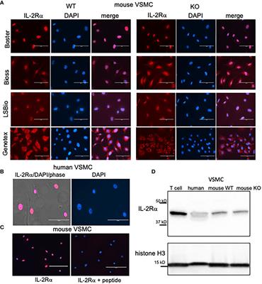 IL-2Rα KO mice exhibit maternal microchimerism and reveal nuclear localization of IL-2Rα in lymphoid and non-lymphoid cells